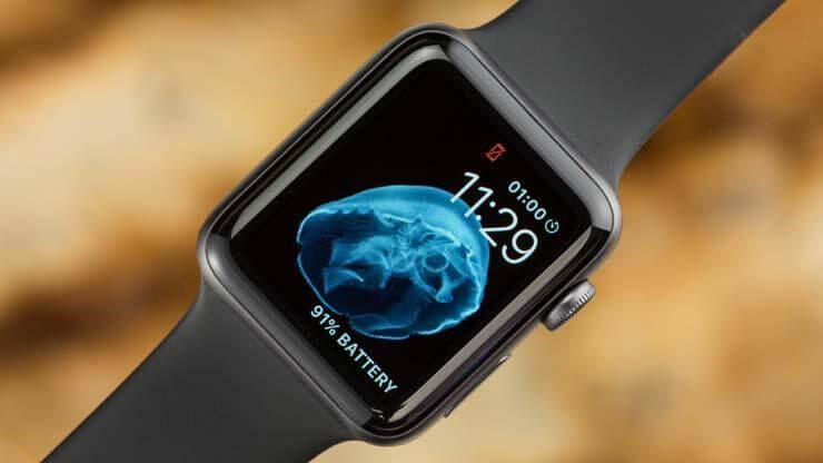 apple watch series