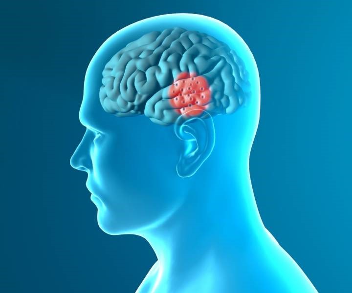 brain hero