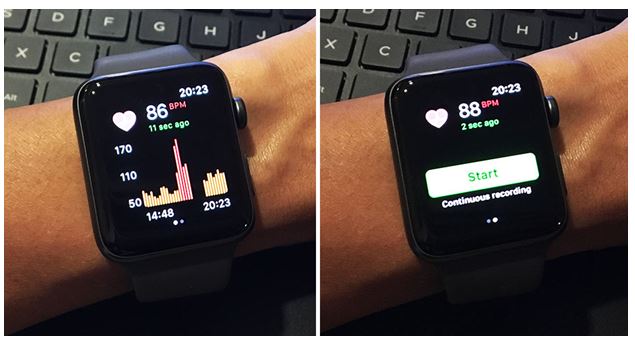 apple watch bpm not working